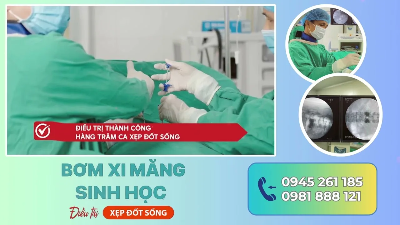Phim giới thiệu dịch vụ: Bơm xi măng sinh học điều trị đốt sống - ProMedia